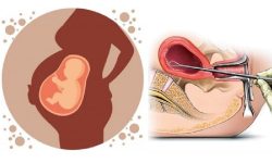गर्भपतनका कारणले लैङ्गिक असन्तुलन बढ्यो