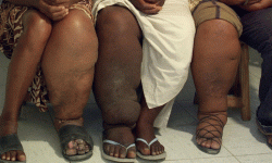 मोरङमा हात्तीपाइलेविरुद्धको औषधि खुवाइने