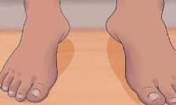 हात्तिपाइले रोगबिरुद्धको औषधी खुवाउने अभियानको समय थपियो