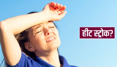 हीट स्ट्रोक तथा हीट एग्जर्सन के हो ?