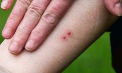 अस्पताल पुर्‍याए बाँच्छन् सर्पदंशका बिरामी