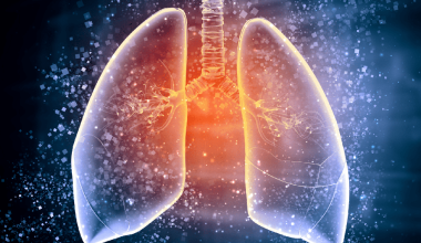 ‘क्षयरोग मुक्त नेपाल अभियान’का लागि एक अर्ब १५ करोड