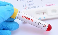 थप १७ जनामा कोरोना संक्रमण