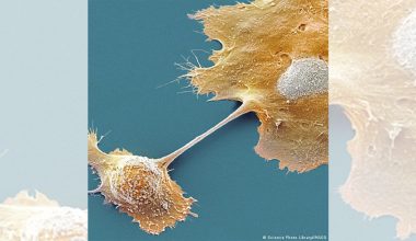 प्यान्क्रियाटिक क्यान्सर रोक्न खोप ? 