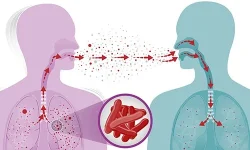 कोशी प्रदेशका तीन जिल्लामा क्षयरोगका बिरामी बढी