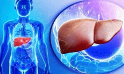 के हो हेपाटाइटिस ? कसरी गर्ने उपचार ?