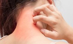 छालाको एलर्जीको वास्तविक कारण के हो ?