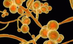 कोरोना भाइरसपछि फेरि क्यान्डिडा ओरिसको डर