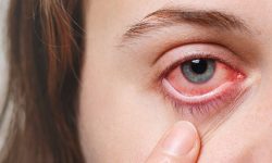 आँखा पाक्ने सङ्क्रमण बढ्दै गएपछि विद्यालय बन्द