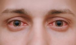 कामदारहरुमा दृष्टिसम्बन्धी समस्या