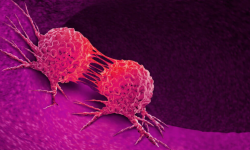 २०२० मा क्यान्सरबाट मात्रै ५३ लाखले गुमाए ज्यान, ७० प्रतिशतलाई बचाउन सकिन्थ्यो