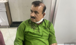 कांग्रेस सहमहामन्त्री यादवमाथि सांघातिक हमला