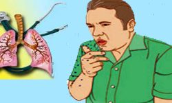 121 new TB patients found in Hariwan