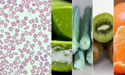 प्लेटलेट कम हुनुका लक्षण र तिनलाई बढाउने मुख्य खानेकुराहरू