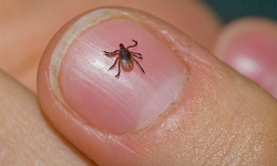 बढयो स्क्रब टाइफसको भय