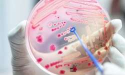 रहस्यमय रोग सेप्सिस