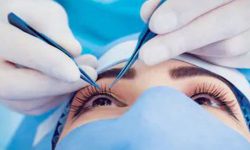 एक सय ५८ जनाले गरे मोतियाबिन्दुको निःशुल्क शल्यक्रिया