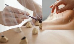 Acupuncture service started in Mugu