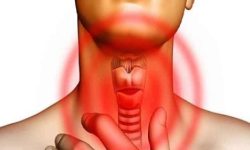 घरमै गर्न सकिने थाइराइडको उपचार