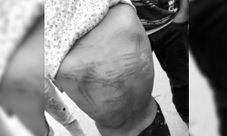 शिक्षकले घरमै गएर कुटे बालिका, कारबाहीको माग गर्दै विद्यालयमा तालाबन्दी