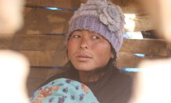 खोरबाट उद्धार गरिएकी फुरदिकुको उपचार