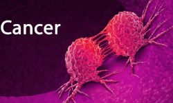 टीकापुरमा पाठेघरको मुखको क्यान्सर परीक्षण शिविर