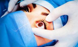 फाप्लुमै मोतिविन्दुको शल्यक्रिया