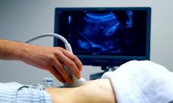 जनशक्तिको अभावले भिडियो एक्स–रे सेवा ठप्प