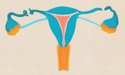 स्थायी बन्ध्याकरण गर्नेमा पुरुषभन्दा महिला बढी