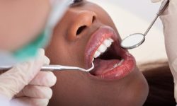 ‘नियमित जाँच गरे मुखसम्बन्धी रोगले जटिलता निम्त्याउँदैन’