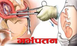 सुरक्षित गर्भपतन सेवा दिवसः मातृमृत्युदरमा सुधार हुँदै