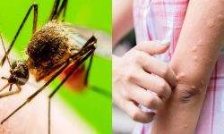 ‘जापनिज इन्सेफ्लाइटिस’को बिरामी फेला : बिरामीको अवस्था सामान्य