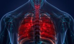 क्षयरोग फेरि विश्वको सबैभन्दा घातक रोग