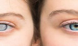 पाँचखालमा मोतियाविन्दु पहिचान शिविर