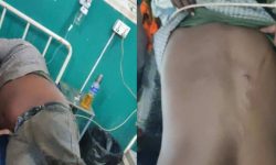 जनकपुरका कवाड व्यवसायी मुकेशमाथि निर्ममतापूर्वक रड प्रहार, ५ जना पक्राउ