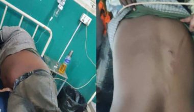 जनकपुरका कवाड व्यवसायी मुकेशमाथि निर्ममतापूर्वक रड प्रहार, ५ जना पक्राउ