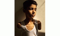 दुवै हात गुमाएका प्यालेस्टिनी बालकको तस्बिर सन् २०२५ को विश्व प्रेस फोटो अफ द इयर