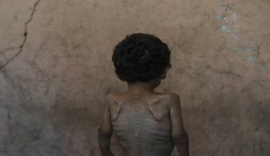 गाजामा ‘अनिकालको सबैभन्दा खराब अवस्था’ भइरहेको छ : खाद्य सङ्कट विशेषज्ञहरू