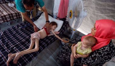 इजरायली अवरोधबीच गाजामा बढ्दो बाल कुपोषणका बारेमा राष्ट्रसङ्घको चेतावनी