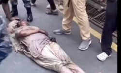 आगजनीमा परी झलनाथ पत्नी घाइते