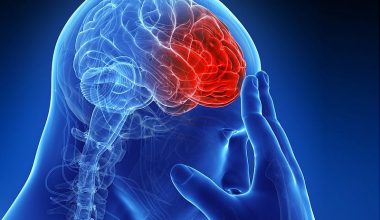 सक्रिय जीवन पद्धति अँगाल्ने आह्वानका साथ आज विश्व पक्षाघात दिवस मनाइँदै