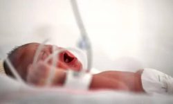 ‘समय नपुगी जन्मिएका शिशुको एक महिनाभित्र अनिवार्य परीक्षण गराउनुपर्ने’